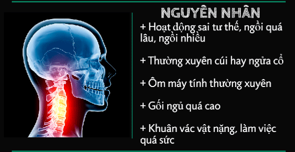 thoát vị đĩa đệm