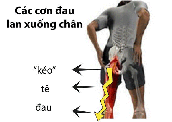 vật lý trị liệu